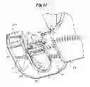 Fig. 08 - Mechanical method and apparatus for bilateral tissue fastening