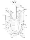Fig. 34 - Mechanical method and apparatus for bilateral tissue fastening