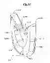 Fig. 35 - Mechanical method and apparatus for bilateral tissue fastening