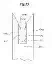 Fig. 37 - Mechanical method and apparatus for bilateral tissue fastening