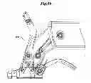 Fig. 40 - Mechanical method and apparatus for bilateral tissue fastening