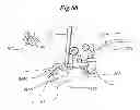 Fig. 44 - Mechanical method and apparatus for bilateral tissue fastening