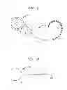 Fig. 07 - Stimulating Device