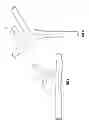 Fig. 02 - Vascular remodeling device