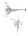Fig. 04 - Vascular remodeling device