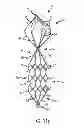 Fig. 10 - Vascular remodeling device