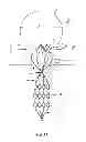 Fig. 11 - Vascular remodeling device