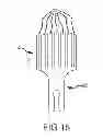 Fig. 15 - Vascular remodeling device