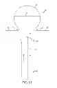 Fig. 17 - Vascular remodeling device
