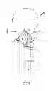 Fig. 18 - Vascular remodeling device