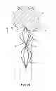 Fig. 22 - Vascular remodeling device
