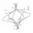 Fig. 29 - Vascular remodeling device