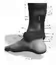 Fig. 02 - Achilles tendon protector