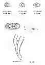 Fig. 07 - Arterial device, system and method for removing embolic debris