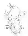 Fig. 09 - Arterial device, system and method for removing embolic debris