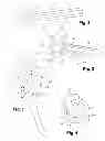 Fig. 02 - Jig for placing a shoulder prosthesis onto a socket