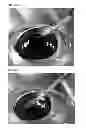 Fig. 22 - INJECTOR FOR EYE