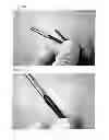 Fig. 25 - INJECTOR FOR EYE