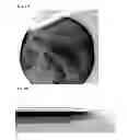 Fig. 27 - INJECTOR FOR EYE