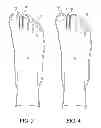 Fig. 03 - Toe Spacer Sock and Corrective Footwear