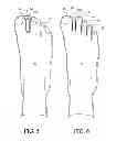 Fig. 04 - Toe Spacer Sock and Corrective Footwear