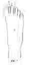 Fig. 05 - Toe Spacer Sock and Corrective Footwear
