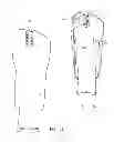 Fig. 13 - Toe Spacer Sock and Corrective Footwear