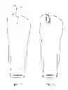 Fig. 14 - Toe Spacer Sock and Corrective Footwear