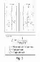 Fig. 04 - LOAD FILTERS FOR MEDIUM VOLTAGE VARIABLE SPEED DRIVES IN ELECTRICAL SUBMERSIBLE PUMP SYSTEMS