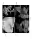 Fig. 07 - MRI pulse sequence based on Q-space trajectory technique