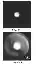 Fig. 07 - Method for reduced field of view MRI in an inhomogeneous field with rapid outer volume suppression