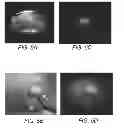Fig. 08 - Method for reduced field of view MRI in an inhomogeneous field with rapid outer volume suppression
