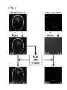 Fig. 05 - Systems and methods for regularized reconstructions in MRI using side information