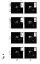 Fig. 08 - Systems and methods for regularized reconstructions in MRI using side information
