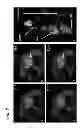 Fig. 09 - Systems and methods for regularized reconstructions in MRI using side information