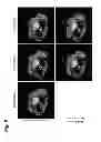 Fig. 10 - Systems and methods for regularized reconstructions in MRI using side information
