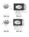 Fig. 06 - Passive Bfield shimming