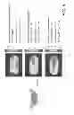 Fig. 07 - Passive Bfield shimming