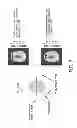 Fig. 08 - Passive Bfield shimming