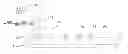 Fig. 01 - Maximally flat frequency coded (MFFC) passive wireless saw RFID tags and sensors