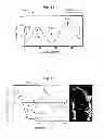 Fig. 09 - Automatic left ventricular function evaluation