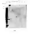 Fig. 16 - Amniotic membrane preparations and purified compositions and anti-inflammation methods