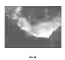 Fig. 35 - Reprogramming of cells to a new fate