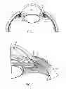 Fig. 02 - Direct visualization system for glaucoma treatment