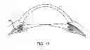 Fig. 08 - Direct visualization system for glaucoma treatment
