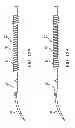Fig. 09 - Direct visualization system for glaucoma treatment