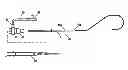 Fig. 01 - Method for diagnosis and treatment of artery