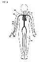 Fig. 06 - Method for diagnosis and treatment of artery