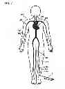 Fig. 07 - Method for diagnosis and treatment of artery