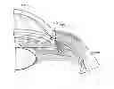 Fig. 01 - Delivery system for ocular implant